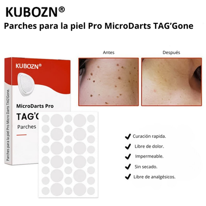KUBOZN® Pro: Adiós verrugas. Sin dolor. Sin marcas. Desde casa.