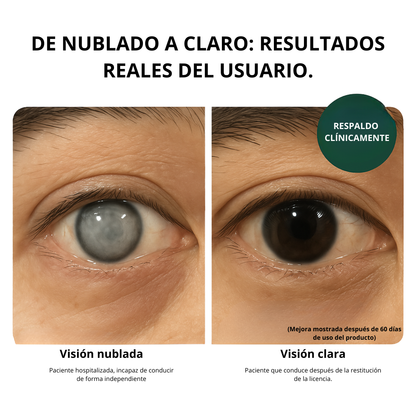 Zoone™ Vitaminas Ojos con Luiteína