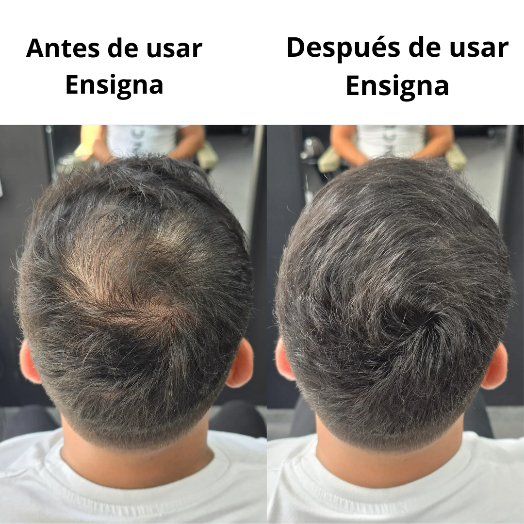 Ensigna CapilFix™ - Cubre al instante el cabello fino